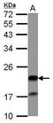 GC-A antibody, PA5-30497, Invitrogen Antibodies, Western Blot image 
