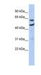CCR4-NOT Transcription Complex Subunit 6 antibody, NBP1-57550, Novus Biologicals, Western Blot image 