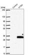 5',3'-Nucleotidase, Mitochondrial antibody, NBP1-92203, Novus Biologicals, Western Blot image 
