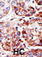Piasx antibody, abx026841, Abbexa, Immunohistochemistry paraffin image 