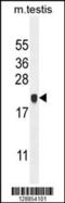 Chromosome 4 Open Reading Frame 46 antibody, 55-678, ProSci, Western Blot image 