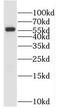 Meiosis Specific Nuclear Structural 1 antibody, FNab05256, FineTest, Western Blot image 