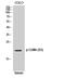 Janus Kinase 1 antibody, A00330S3, Boster Biological Technology, Western Blot image 
