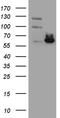 ER-beta antibody, TA801038, Origene, Western Blot image 