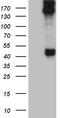 Keratin 35 antibody, LS-C796130, Lifespan Biosciences, Western Blot image 