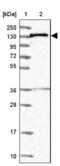 N(Alpha)-Acetyltransferase 16, NatA Auxiliary Subunit antibody, NBP1-92167, Novus Biologicals, Western Blot image 