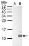 PPY antibody, GTX128056, GeneTex, Western Blot image 