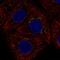 Androgen Induced 1 antibody, HPA060766, Atlas Antibodies, Immunofluorescence image 