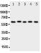 Amiloride-sensitive cation channel 3 antibody, PA1938, Boster Biological Technology, Western Blot image 