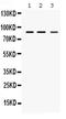 MEFV Innate Immuity Regulator, Pyrin antibody, PB9667, Boster Biological Technology, Western Blot image 