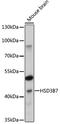 Hydroxy-Delta-5-Steroid Dehydrogenase, 3 Beta- And Steroid Delta-Isomerase 7 antibody, 18-097, ProSci, Western Blot image 