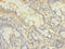 DDHD Domain Containing 2 antibody, A58742-100, Epigentek, Immunohistochemistry paraffin image 
