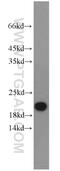 Proline-rich acidic protein 1 antibody, 11932-1-AP, Proteintech Group, Western Blot image 