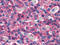 Calcium Sensing Receptor antibody, TA340815, Origene, Immunohistochemistry paraffin image 