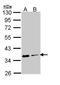Aspartoacylase antibody, TA308661, Origene, Western Blot image 