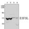 Eukaryotic Translation Initiation Factor 3 Subunit L antibody, PA5-75972, Invitrogen Antibodies, Western Blot image 