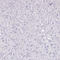 Cancer/Testis Antigen Family 45 Member A1 antibody, HPA044735, Atlas Antibodies, Immunohistochemistry paraffin image 