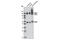 Solute Carrier Family 1 Member 3 antibody, 5684S, Cell Signaling Technology, Western Blot image 