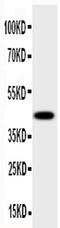 Hydroxysteroid 17-Beta Dehydrogenase 2 antibody, PA5-79402, Invitrogen Antibodies, Western Blot image 