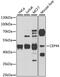 Centrosomal Protein 44 antibody, 23-506, ProSci, Western Blot image 