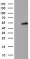 Lipoprotein Lipase antibody, TA503786S, Origene, Western Blot image 