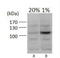 Hypoxia-inducible factor 1-alpha antibody, TA336308, Origene, Western Blot image 
