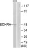 Endothelin Receptor Type A antibody, LS-B7963, Lifespan Biosciences, Western Blot image 