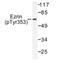 Ezrin antibody, AP01585PU-N, Origene, Western Blot image 