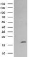 Cancer/Testis Antigen 1B antibody, CF505968, Origene, Western Blot image 