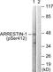 ARRB1 antibody, AP55695PU-S, Origene, Western Blot image 