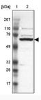 G Protein-Coupled Receptor Kinase 3 antibody, NBP1-90008, Novus Biologicals, Western Blot image 