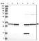 Annexin A5 antibody, HPA035330, Atlas Antibodies, Western Blot image 