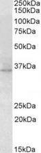 11-cis retinol dehydrogenase antibody, TA311250, Origene, Western Blot image 