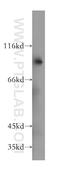 Solute Carrier Family 3 Member 1 antibody, 16343-1-AP, Proteintech Group, Western Blot image 