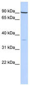 Homeobox protein Nkx-2.5 antibody, TA341802, Origene, Western Blot image 