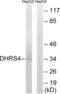 Dehydrogenase/Reductase 4 antibody, abx014421, Abbexa, Western Blot image 
