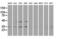 Retinol Dehydrogenase 14 antibody, LS-C337246, Lifespan Biosciences, Western Blot image 