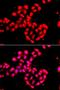 Calcium/Calmodulin Dependent Protein Kinase ID antibody, LS-C349206, Lifespan Biosciences, Immunofluorescence image 