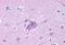 Neuropeptide Y Receptor Y5 antibody, GTX71109, GeneTex, Immunohistochemistry paraffin image 