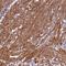 Coiled-Coil Domain Containing 102B antibody, NBP1-89260, Novus Biologicals, Immunohistochemistry frozen image 