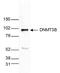 DNA (cytosine-5)-methyltransferase 3B antibody, NBP2-59291, Novus Biologicals, Western Blot image 