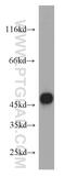 Fatty Acid Desaturase 3 antibody, 15205-1-AP, Proteintech Group, Western Blot image 