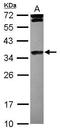 Histone Cluster 1 H1 Family Member E antibody, GTX121670, GeneTex, Western Blot image 