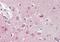 Origin Recognition Complex Subunit 3 antibody, orb18313, Biorbyt, Immunohistochemistry paraffin image 