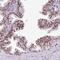 Protein FAM182B antibody, PA5-62134, Invitrogen Antibodies, Immunohistochemistry paraffin image 