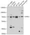 Aspartyl-tRNA synthetase, mitochondrial antibody, GTX65963, GeneTex, Western Blot image 