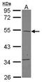 TBC1 Domain Family Member 10C antibody, GTX121080, GeneTex, Western Blot image 