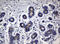 Sialyl Lewis a antibody, LS-C783991, Lifespan Biosciences, Immunohistochemistry paraffin image 