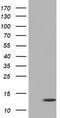 Follicle Stimulating Hormone Subunit Beta antibody, TA501623BM, Origene, Western Blot image 