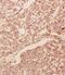 Glial Cell Derived Neurotrophic Factor antibody, PA1465, Boster Biological Technology, Immunohistochemistry paraffin image 